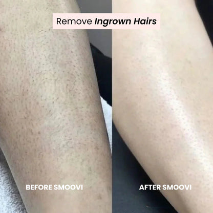 Divarys 2.0 Bikini Shaver