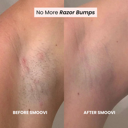 Divarys 2.0 Bikini Shaver