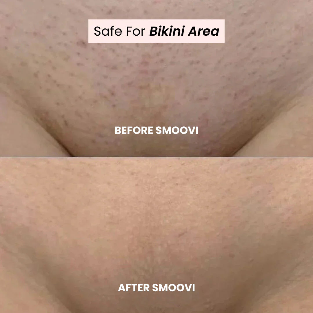 Divarys 2.0 Bikini Shaver