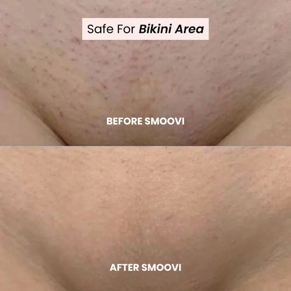Divarys 2.0 Bikini Shaver